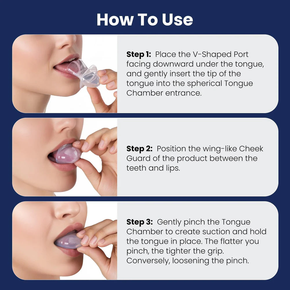 Anti-Snoring Tongue Retainer